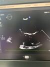 PHILIPS X5-1 Ultrasound Transducer