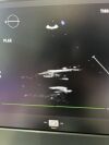 PHILIPS X5-1 Ultrasound Transducer