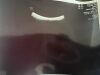 GE HEALTHCARE eM6C Ultrasound Transducer