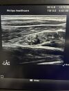 PHILIPS L12-5 Ultrasound Transducer