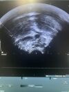 B&K 8808e Ultrasound - Urology