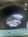 B&K 8808e Ultrasound - Urology