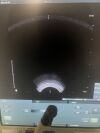 B&K 8808e Ultrasound - Urology