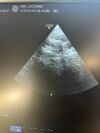GE 6Tc Ultrasound Transducer