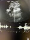 GE C2-9-D Ultrasound Transducer