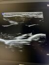 PHILIPS L12-3 Ultrasound Transducer