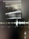 GE 9L-D Ultrasound Transducer
