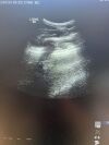 GE HEALTHCARE GE M6C Ultrasound Transducer