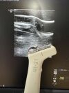 GE L8-18i-D Ultrasound Transducer