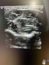 GE 9L-D Ultrasound Transducer
