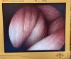 OLYMPUS A2010A (0 Degree) Rigid Telescope. Laparoscope
