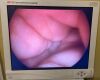 OLYMPUS 0 DEGREE. Endoscope