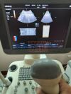 MINDRAY 4CD4 Ultrasound Transducer