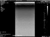 PHILIPS eL18-4 Ultrasound Transducer