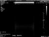 PHILIPS eL18-4 Ultrasound Transducer