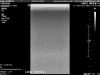 PHILIPS eL18-4 Ultrasound Transducer