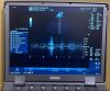 GE Logiq e Portable BT (R7.0.1) BT12 w/ Cardiac (3s-rs) & Linear (8l-rs) Probes..