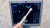 GE Logiq S8 R2 2014 with three probes included General ultrasound