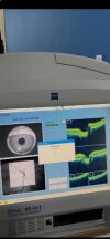 CARL ZEISS Cirrus 4000 HD OCT
