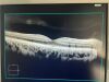 CARL ZEISS Cirrus HD-OCT 5000 OCT