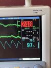 DATASCOPE MINDRAY TRIO PATIENT MONITOR (Well Tested). Module