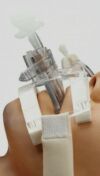 SMITHS MEDICAL SecureEasy Â®,242003 Endotracheal Tube Holder, Adult-Nonsterile -  242003 - Case