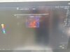 GE LOGIQ S8 Ultrasound - Shared Service