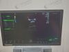 GE Voluson S8 Ultrasound - OB / GYN