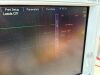 DATASCOPE 2LT Monitor