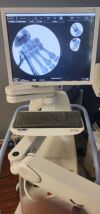 HOLOGIC Insite II C-Arm