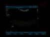 PHILIPS C5-2 Ultrasound Transducer