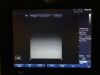 PHILIPS L12-5 / 50 Ultrasound Transducer