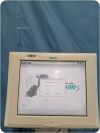 NATUS Algo 5 BORN HEARING SCREENER