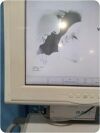 NATUS Algo 5 BORN HEARING SCREENER