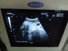 TOSHIBA PLQ-662A Ultrasound Transducer