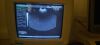 SAMSUNG-MEDISON EC4-9ES Ultrasound Transducer