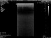 PHILIPS L15-7i0 Ultrasound Transducer