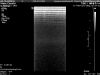 PHILIPS L15-7i0 Ultrasound Transducer