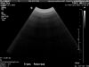 PHILIPS C92 Ultrasound Transducer
