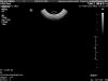 PHILIPS 3D9-3V Ultrasound Transducer