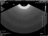 PHILIPS 3D9-3V Ultrasound Transducer
