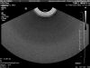 PHILIPS 3D9-3V Ultrasound Transducer