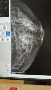 GE Senographe Pristina 3D Digital Mammo Unit
