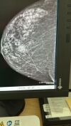 GE Senographe Pristina 3D Digital Mammo Unit
