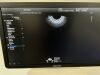 SAMSUNG WS80A Elite Ultrasound - OB / GYN