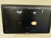SAMSUNG WS80A Elite Ultrasound - OB / GYN