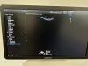 SAMSUNG WS80A Elite Ultrasound - OB / GYN