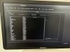 SAMSUNG WS80A Elite Ultrasound - OB / GYN
