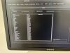 SAMSUNG WS80A Elite Ultrasound - OB / GYN