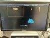 SAMSUNG WS80A Elite Ultrasound - OB / GYN